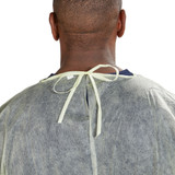 McKesson Protective Procedure Gown One Size Fits Most Yellow NonSterile Not Rated Disposable, 16-NFENWTCY8-OSFM, Case of 100