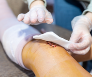 Infection Control at Home: Best Practices for Using and Disposing of Medical Supplies