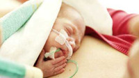 G-Tube Extension Set NuTrio 12 Inch Length 1.20 mL Priming Volume Sterile TL002 Case/50 TL002 MEDELA INC 994207_CS