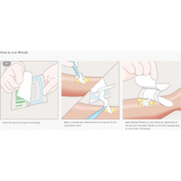 Impregnated Dressing Mesalt 6 X 6 Inch Viscose / Polyester Sodium Chloride Sterile 285780 Box/30 285780 MOLNLYCKE HEALTH CARE US LLC 400463_BX