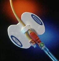 Stabilization Device Statlock FOL0101 Each/1 FOL0101 BARD MEDICAL DIVISION 709113_EA
