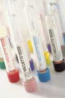 VACUETTE Venous Blood Collection Tube K2 EDTA Additive 13 X 100 mm 6 mL Lavender / Black Ring Pull Cap Polyethylene Terephthalate PET Tube 456002 Pack/50 FOL0101 Greiner Bio-One 505508_PK