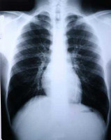 X-Ray Film Clear Choice Performance 10 X 12 Inch Medium Speed Green Sensitive High 55OXA Case/500 5-1210 MCK BRAND 456488_CS