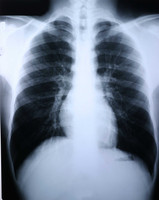 Clear Choice Performance X-Ray Film - Case of 500 55BUN Clear ChoiceÂ™ Performance 456489_CS