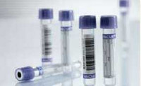 VACUETTE® Venous Blood Collection Tube K3 EDTA Additive 4 mL Pull Cap Polyethylene Terephthalate (PET) Tube 454021 Box of 50 454021 VACUETTE® 416962_BX
