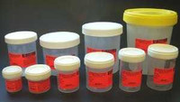 Prefilled Formalin Container SP® 30 mL Fill in 60 mL (2 oz.) Screw Cap Warning Label / Patient Information NonSterile C4320-30B Pack of 50 C4320-30B SP® 332980_PK
