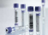 VACUETTE® Venous Blood Collection Tube K3 EDTA Additive 9 mL Pull Cap Polyethylene Terephthalate (PET) Tube 455036 Case of 1200 455036 VACUETTE® 416969_CS