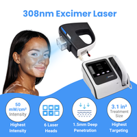 308nm Excimer Laser UVB Light Therapy – Highest Intensity and Precision UV Light for Severe Psoriasis and Vitiligo 