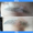 308nm Excimer Laser UVB Light Therapy – Highest Intensity and Precision UV Light for Severe Psoriasis and Vitiligo 