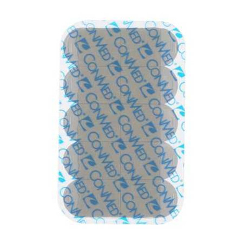 EKG Tab Electrode Fastrace 4 Resting Non-Radiolucent 100 per Pack 1915-100 Case/1000 1915-100 CONMED 183226_CS