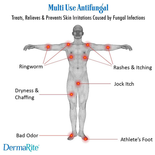 Antifungal DermaFungal 2% Strength Cream 3.75 oz. Tube 00234 Case/24 234 DERMARITE INDUSTRIES LLC 584144_CS