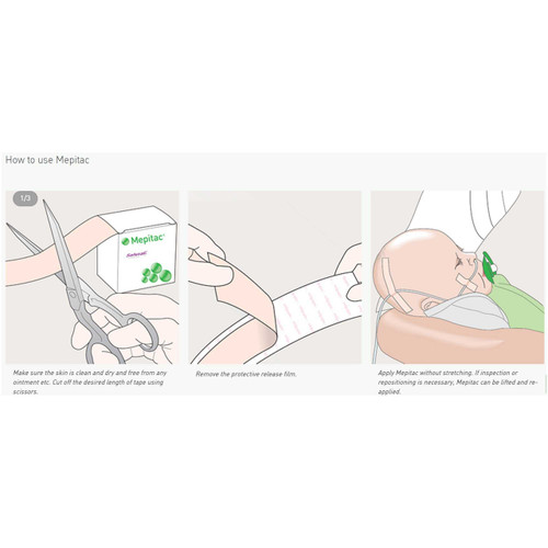 Medical Tape Mepitac Skin Friendly Silicone 1-1/2 X 59 Inch NonSterile 298400 Case/12 298400 MOLNLYCKE HEALTH CARE US LLC 683386_CS