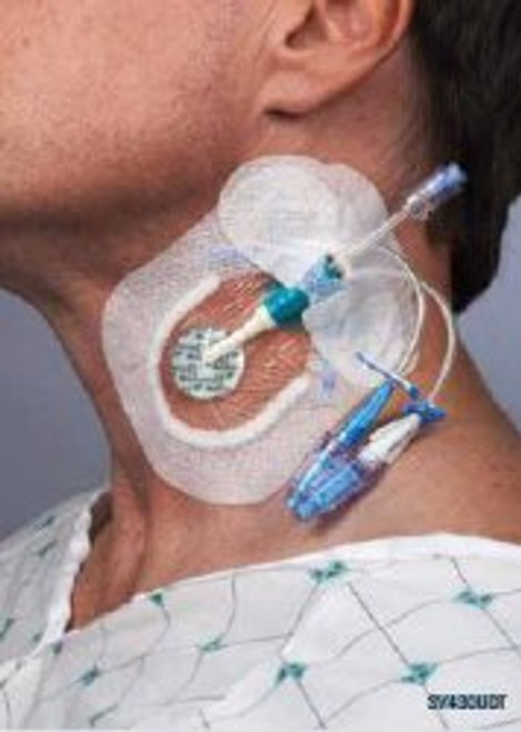 Sorbaview SHIELD Integrated Securement Dressing Fabric / Film 3-3/4 X 4-3/4 Inch Sterile, SV430UDT, Pack of 1