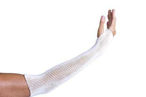 Elastic Net Retainer Dressing McKesson Tubular Elastic 47 Inch X 25 Yard 119.4 cm X 22.9 m Size 11 White 2X-Large Chest / Back / Perineum / Axilla NonSterile MSVP114711 Case/10 79-71975 MCK BRAND 1113355_CS