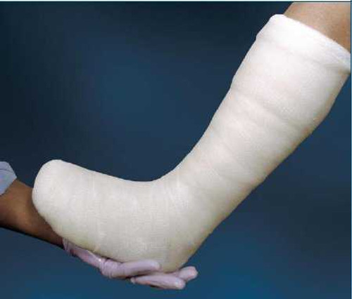 Total Contact Cast System CutimedOff-Loader Select Cotton / Elastic / Felt / Fiberglass / Foam / Plaster of Paris / Stockinette White 7800901 Kit/1 4402 BSN Medical 771736_KT