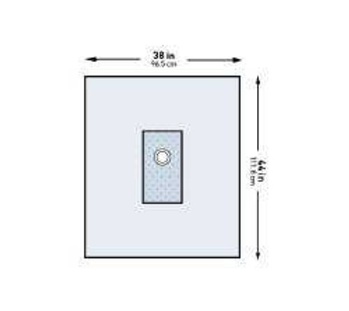 Cardiovascular Drape McKesson Brachial Angiography Drape 38 W X 44 L Inch Sterile 183-I80-01164G-S Pack/1 66753/NA/NA/LG MCK BRAND 1101277_PK