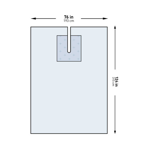 EENT Drape McKesson EENT Split Drape 76 W X 124 L Inch Sterile 183-I80-09143G-S Pack/1 8343-R MCK BRAND 1101300_PK