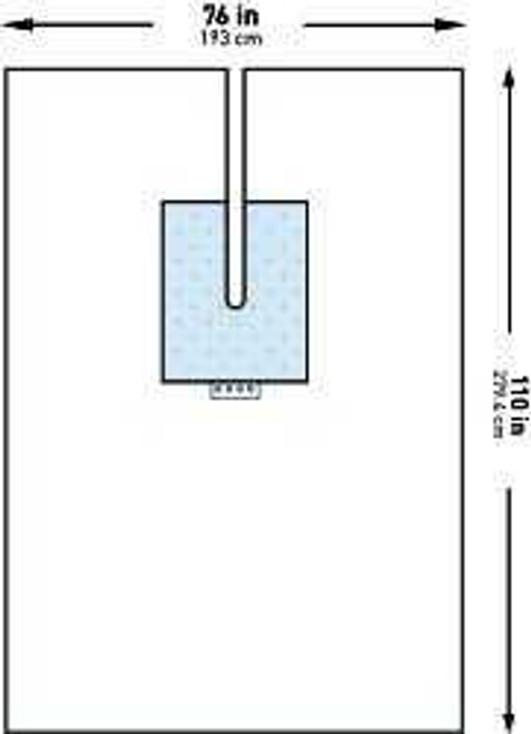 Orthopedic Drape McKesson U-Drape with Split 76 W x 110 L Inch Sterile 183-I80-09178-S Case of 24 839001 McKesson 1101302_CS