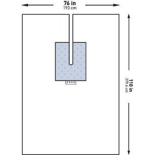 Orthopedic Drape McKesson U-Drape with Split 76 W x 110 L Inch Sterile 183-I80-09178-S Pack of 1