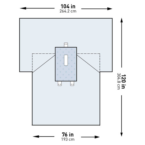 Abdominal Drape McKesson Laparotomy Drape 102 W X 76 W X 120 L Inch Sterile 183-I80-05170G-S Case/13 A50114 MCK BRAND 1101288_CS