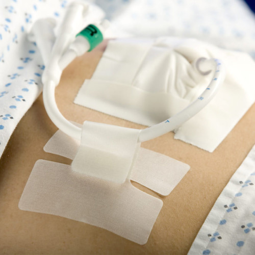 Cath-Secure Multi-Purpose Tube Securement, 5445-3, Case of 400