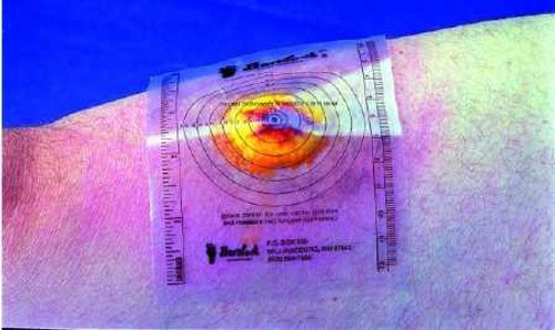Measuring Guide 3-3/4 X 5-1/2 Inch Plastic B250 Box/250 703220050 Trademark Medical 233315_BX