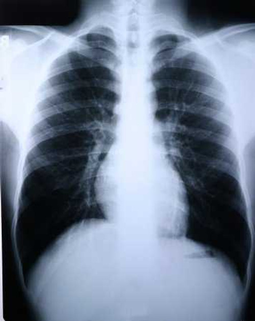 X-Ray Film Clear Choice Performance 10 X 12 Inch Medium Speed Green Sensitive High 55OXA Case/500 5-1210 MCK BRAND 456488_CS