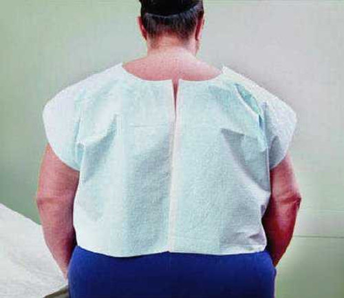 Exam Cape Tidi Blue X-Large Front / Back Opening Without Closure Unisex 910517 Case/100 2001 Tidi Products 983945_CS
