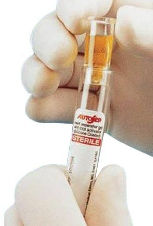 Monoject Ezee-Nest Sample Cup For 13 mm Collection Tubes Case of 5000