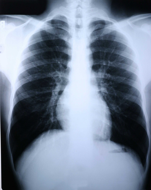 Clear Choice Performance X-Ray Film - Case of 500 55BUN Clear ChoiceÂ™ Performance 456489_CS