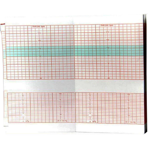 Fetal Diagnostic Monitor Recording Paper Edan® Thermal Paper 90 mm x 152 mm Roll Red Grid M25R-75111 Box of 3 M25R-75111 Edan® 1051250_BX