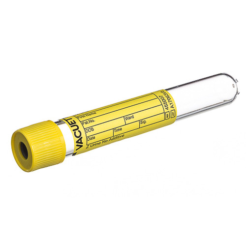 Vacuette Z Urine No Additive Urinalysis Tube Plain 10.5 mL, Pull Cap (PET), 455007, Case of 1200