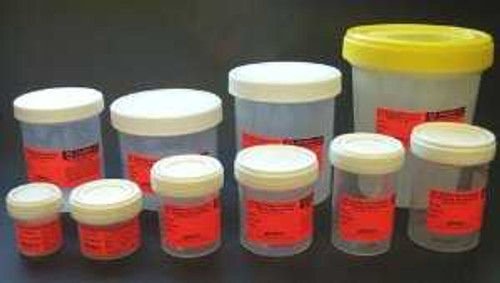 Prefilled Formalin Container SP® 30 mL Fill in 60 mL (2 oz.) Screw Cap Warning Label / Patient Information NonSterile C4320-30B Pack of 50 C4320-30B SP® 332980_PK
