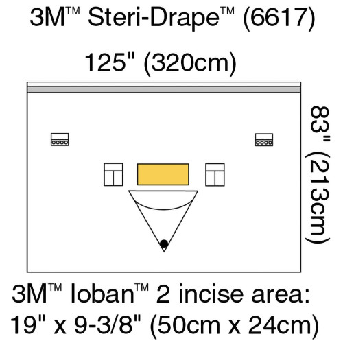 Orthopedic Drape 3M Steri-Drape Isolation Drape with Incise and Pouch 125 W x 83 L Inch Sterile 6617 Box of 5