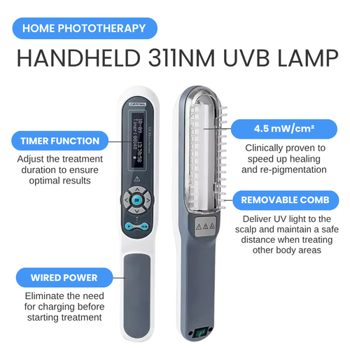 Corded, Handheld 311nm UVB Lamp - Light Therapy for Psoriasis or Vitiligo on Scalp, Face, Neck, Hands and Feet