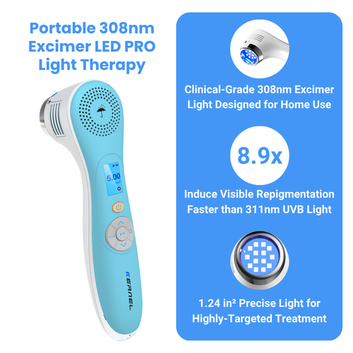 Portable 308nm Excimer LED UVB Light PRO – Higher Intensity, Higher Targeting Light Therapy for Vitiligo​ – Light Intensity 40 mw/cm²