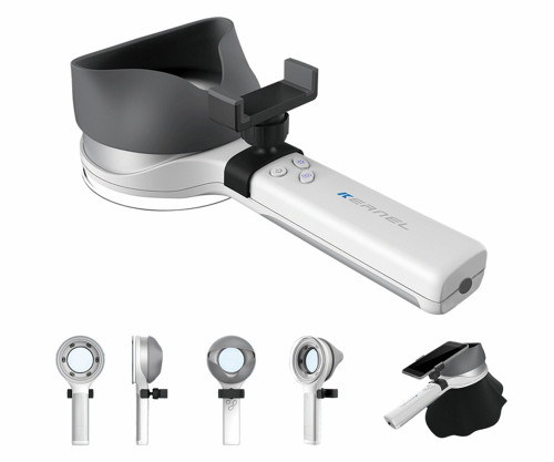 Wood’s Lamp, LED UVA Skin Analyzer with 2X Magnifying Lens & 3-Level White Light Wood’s Lamp, LED UVA Skin Analyzer with 2X Magnifying Lens & 3-Level White Light