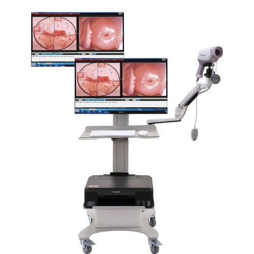 Kernel 4K Digital Video Colposcope – Compatible for Dual Monitor – KN2200I4K