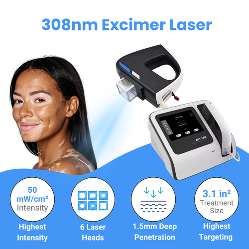 308nm Excimer Laser UVB Light Therapy – Highest Intensity and Precision UV Light for Severe Psoriasis and Vitiligo 
