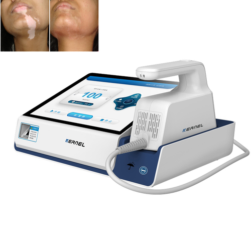 308nm Excimer LED High-power UV Light Therapy – Both Time and Dose Mode - MED Test Included