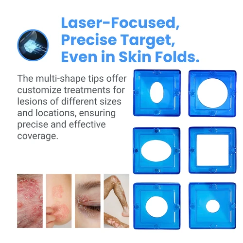 308nm Excimer LED High-power UV Light Therapy, Time & Dose Dual Mode, MED Test Included KN308E_EA
