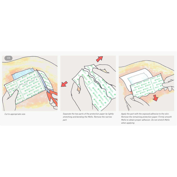 Perforated Dressing Retention Tape with Liner Mefix® White 4 Inch x 11 Yard Nonwoven Spunlace Polyester NonSterile 311099 Box of 1 311099 Mefix® 684056_BX
