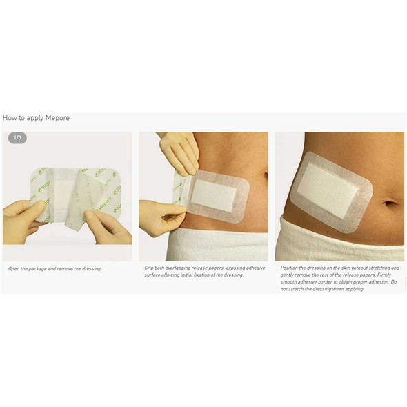 Adhesive Dressing Mepore 2.4 X 2.8 Inch Nonwoven Spunlace Polyester Rectangle White Sterile 670800 Each/1 670800 MOLNLYCKE HEALTH CARE US LLC 324383_EA