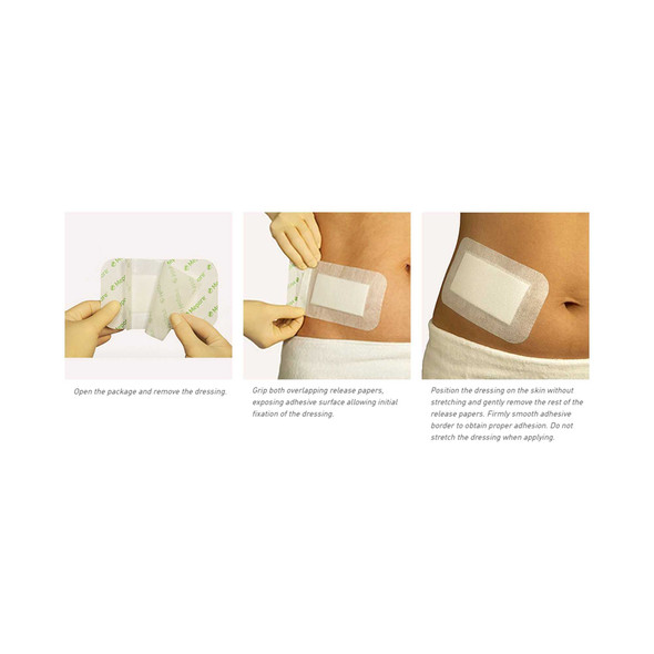 Absorbent Dressing Mepore 3-1/2 X 14 Inch 671400 Box/30 671400 MOLNLYCKE HEALTH CARE US LLC 337355_BX