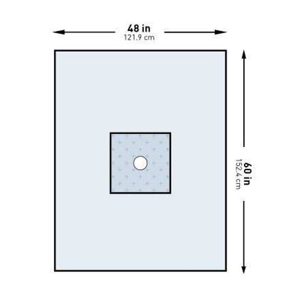 Surgical Drape McKesson Minor Procedure Drape 48 W X 60 L Inch Sterile 183-I80-05178G-S Case/20 80192 MCK BRAND 1101260_CS