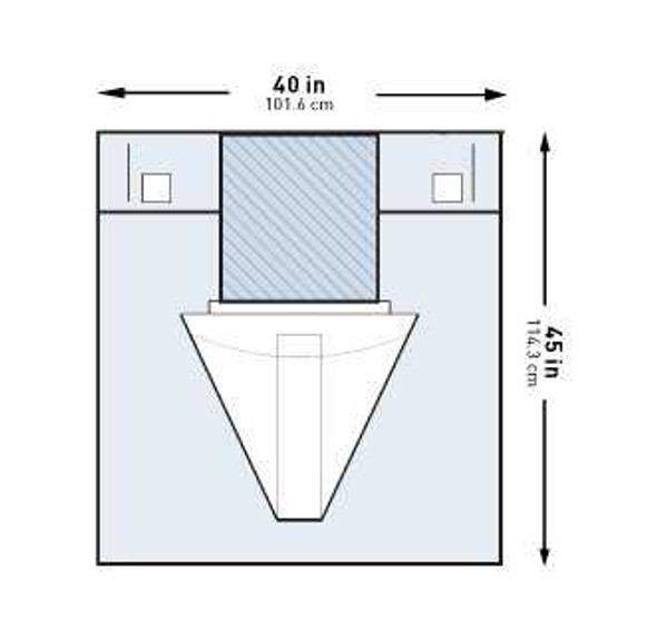 Obstetrics / Gynecology Drape McKesson Under Buttocks Drape 40 W X 45 L Inch Sterile 183-I80-14112-S Case/25 708A MCK BRAND 1101265_CS