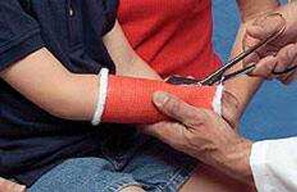 Cast Tape Delta-Cast® Conformable 2 Inch x 12 Foot Polyester Black 7212 Box of 10 7212 Delta-Cast® Conformable 455484_BX
