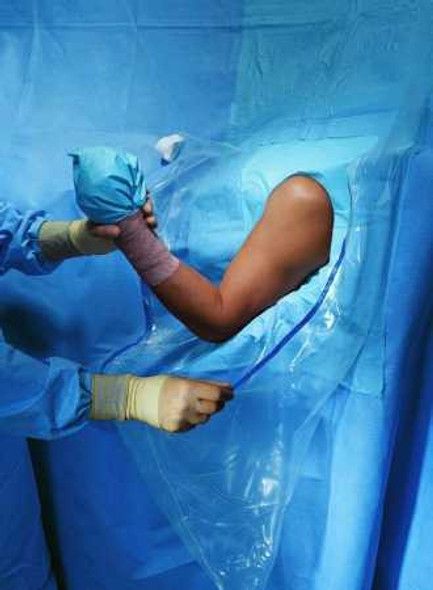 Orthopedic Drape Shoulder Arthroscopy Drape 160 W x 102 L Inch Sterile 89070 Pack of 1 89070 O&M Halyard Inc 472658_EA