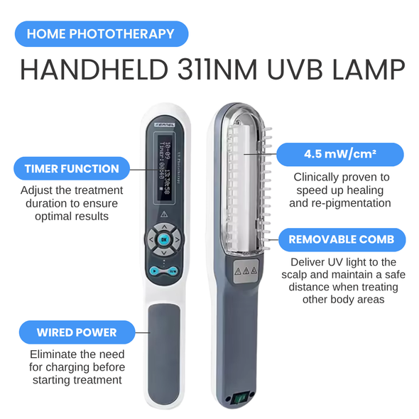 Corded, Handheld 311nm UVB Lamp - Light Therapy for Psoriasis or Vitiligo on Scalp, Face, Neck, Hands and Feet