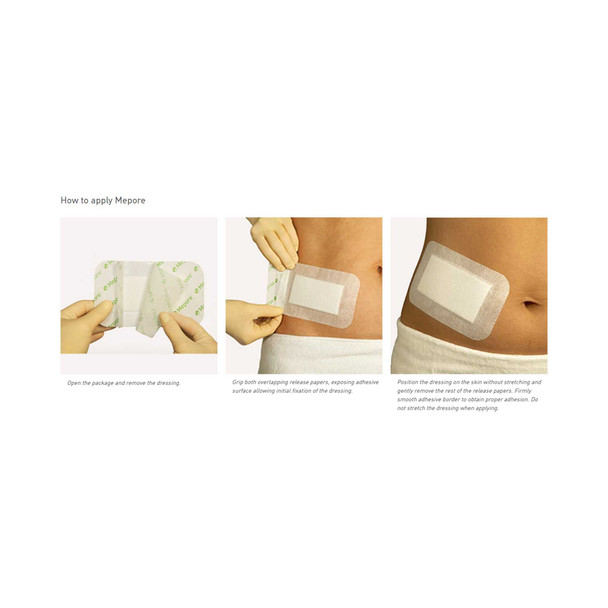 Adhesive Dressing Mepore3-3/5 X 12 Inch Nonwoven Spunlace Polyester Rectangle White Sterile 671300 Box/30 368101 Molnlycke 851135_BX